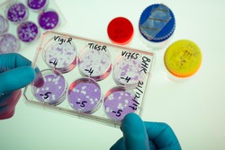Virus research.The photo shows a 'plaque assay' with which the specialists determine the amount of infectious virus particles.