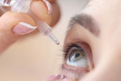 Woman drips eye drops into her eyes. Eye diseases and their treatment concept