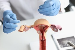 Doctor gynecologist ligates fallopian tubes on example of layout female reproductive system. Contraception concept for unwanted pregnancy