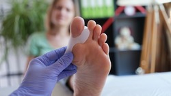 Doctor examines leg with hallux valgus deformity of first toe. Foot deformity treatment concept