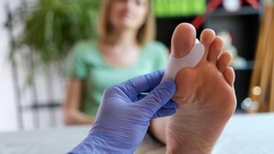 Close-up of doctor orthopedist examining leg with hallux valgus deformity of first toe. Deformity of joints of foot concept