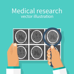 Medical research concept. CT-scans, X-ray human head brain images  in doctor hand. Diagnostic Laboratory. Studying analysis. Vector illustration flat design. Attentively examines MRI scan.