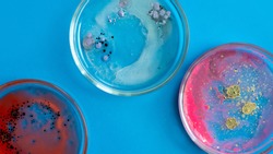 Viruses and bacteria in a Petri dish, various analyses in the laboratory. Virology and virus research, concept. blue background copy space.