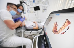 Dentist scanning patient's teeth with modern scanning machine. Digital print of patient's teeth is on big screen. Modern high precision technologies. Concept of modern dentistry