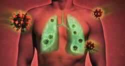 illustrative image of lung damage by coronavirus covid-19. Human anatomy. Concept