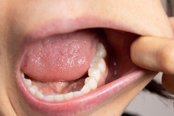 Lower molar teeth close up