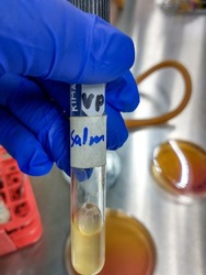 Salmonella bacteria test in Voges Proskauer Medium
