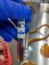Salmonella bacteria test in LIA Medium
