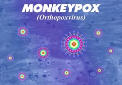 Monkeypox is a viral zoonosis (a virus transmitted to humans from animals). Orthopoxvirus Virus