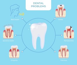 Dental problems circled scheme medical educational poster with diagnosis names vector flat illustration. Tooth disease bad breath, caries, periodontitis, calculus, gingivitis, sensitive teeth