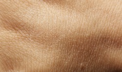 skin texture human