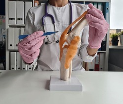 Surgeon holds scalpel near model of knee joint. Concept of knee surgery and cruciate ligament replacement