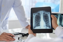 radiology and medicine concept. doctor explaining the results of scan lung on digital tablet screen to patient.