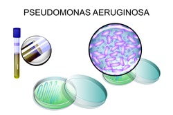 Pseudomonas aeruginosa. bacterial inoculation