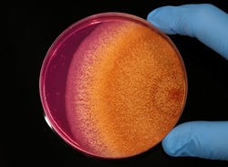 Pigmented colony of a fungus (microorganism) growing on a microbiological culture plate in a Microbiology laboratory