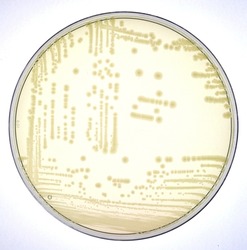 Growth of colonies of Escherichia coli bacteria in Luria medium with agar, in the microbiology laboratory
