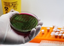 Plaque with a culture of the food-contaminating bacterium Escherichia coli, growing in the Microbiology laboratory