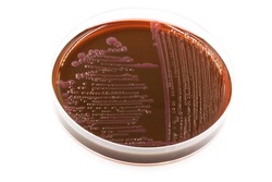 Salmonella Typhimurium bacteria growing on a selective medium in the laboratory of microbiology	