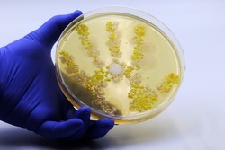 Germs on hands: colonies of bacteria and fungi in the hand of a young girl after playing outside. Concept of hand hygiene	