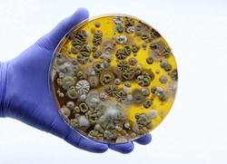 Microorganisms found in the environment, mainly fungi
