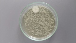 Escherichia coli colonies in triptic soy agar with one colony of contaminant bacteria