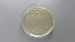Escherichia coli DH5-alpha colonies in triptic soy agar. Total plate count. Serial dilution 1:1,000,000 