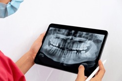 
Dentist reviewing the x-ray on an ipad to indicate to the patient his dental treatment. Woman dentist holding a tablet