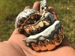gold grillz bling bling teeth. Custom jewelry fashion photo. 10 karat, 14 karat, 24 karat gold iced out.