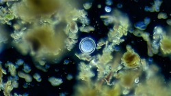 Unicellular micro organism, microscope magnification