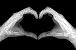 x-ray image of hands making heart symbols.