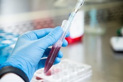 cell culture experiments at cell culture laboratory 