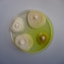 Microbiology microorganisms agar plate count phytopathology