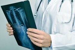 closeup of a young caucasian doctor man observing a skeleton radiograph