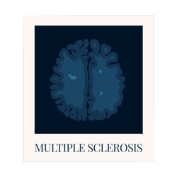 Multiple sclerosis awareness poster with an MRI scan of the brain affected by MS. Central nervous system disease. Medical concept. Vector illustration.