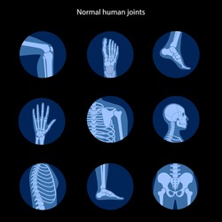 Spine, knee, skull and other human joints icon. Normal bones anatomy. Skeletal x ray medical poster. Orthopedic or chiropractic treatment. Anatomical logo for clinic. Isolated flat vector illustration