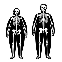 Skeleton system human bones concept. X ray with overweight male and female silhouette. Skull, arms, legs, knee and foot. Ribs and hand joints. Obese man, and woman body anatomical vector illustration.