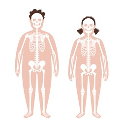 Skeleton system human bones concept. X ray with overweight boy and girl silhouette. Skull, arms, legs, knee and foot. Ribs and hand joints. Obese child body anatomical isolated vector illustration.