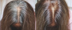 Close up to gray hair root on old woman head , before and after coloring hair concept