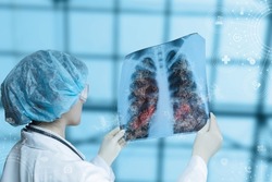 Concept of glass in sick lungs from coronavirus pneumonia. The doctor looks at a snapshot of the lungs .