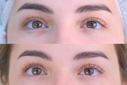 Woman's lashes after and before beauty procedure of eyelash lifting and laminating in beauty clinic, eyes closeup. Young woman in cosmetology clinic with open eyes. Lift of lash and eyelash.