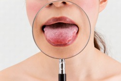 Enlarge a woman's tongue with a magnifying glass.