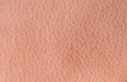 background of a pink skin texture of a man covered with pores and small goosebumps