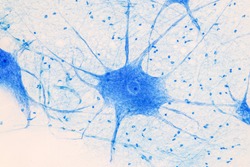 Motor Neuron under the microscope in Lab.
