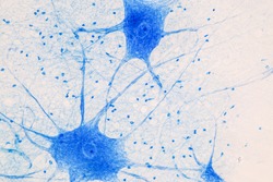 Motor Neuron under the microscope in Lab.
