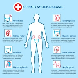 Medical infographics of urinary system diseases. Vector illustration