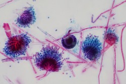 Aspergillus (mold) under the light microscopic view for education.