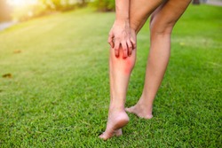 Women with his feet, itching on the lawn caused by insect bites and stings/health and medical view and devising concepts.