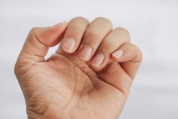  closeup of man  finger nail 