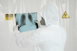 Doctor man with X-ray of lungs, fluorography, roentgen isolated on white background. Coronavirus concept.