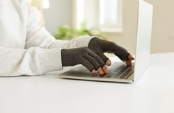 Man with rheumatoid arthritis types text on laptop wearing special compression gloves. Side view close up of hands of young man wearing gray medical cloth gloves struggling with sharp pain his hands